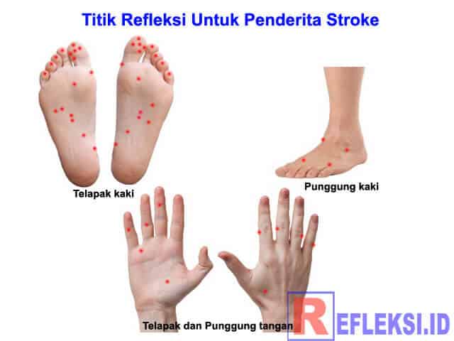 Titik Refleksi stroke