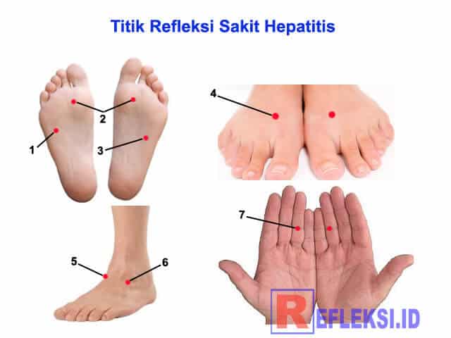 Titik refleksi hepatitis