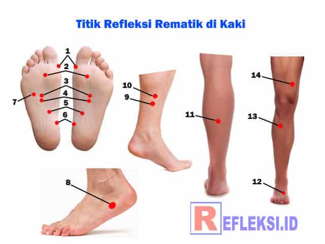 Titik refleksi rematik di kaki